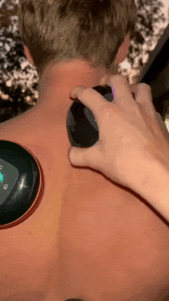 MASAJEADOR ELÉCTRICO DE VENTOSA