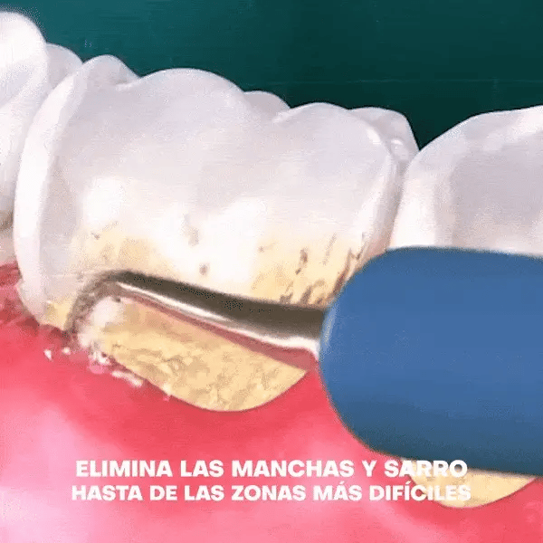 Limpiador Dental Ultrasonico